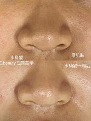 点击看大图 -E.beauty驻颜·痘敏肌调理中心