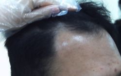 -雍禾植发全国连锁