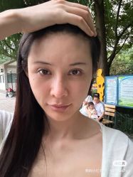 体验后-上海漾颜医疗美容