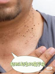 -清疣美疣·痣·斑净肤中心
