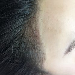 点击看大图 -西施无菌半永久纹绣眉眼影唇轻增发纹发际线