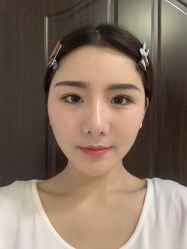 体验后-禾美嘉医疗美容