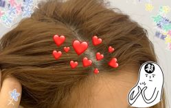 -大麦微针植发全国连锁