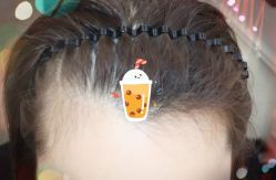 -大麦微针植发全国连锁