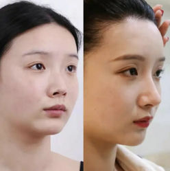 -素美医疗美容·西南眼鼻整形·修复基地