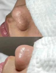 -美愈美肤MEIYU SKIN