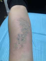 -秦好山专业洗纹身