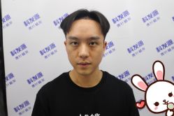 -大麦微针植发丨全国连锁