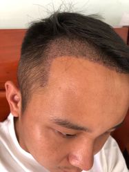 -熙朵美学植发连锁