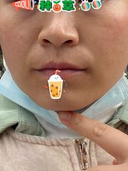 -针美汇欧邦医疗美容