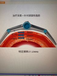 -Fundi张玉珊修身堂·indiba·BTL科技瘦身