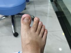 -Andrew指甲专科灰指甲·甲沟炎矫正·3D步态矫形鞋垫定制(浦三路店)
