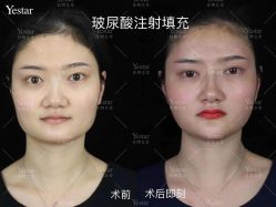 -Yestar艺星医疗美容医院