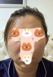 点击看大图 -苗方清颜•痘肌问题肌专研