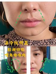 -广州美莱医疗美容医院
