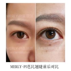 -MLP美丽派·问题肌疗愈中心
