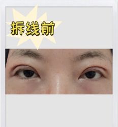 -素美医疗美容·西南眼鼻整形·修复基地