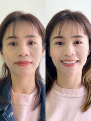 点击看大图 -广州健丽·去眼袋医疗美容机构