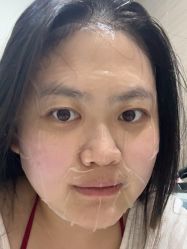 体验后-上海漾颜医疗美容