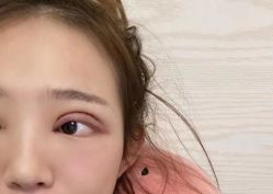 -西安壹加壹医疗美容医院