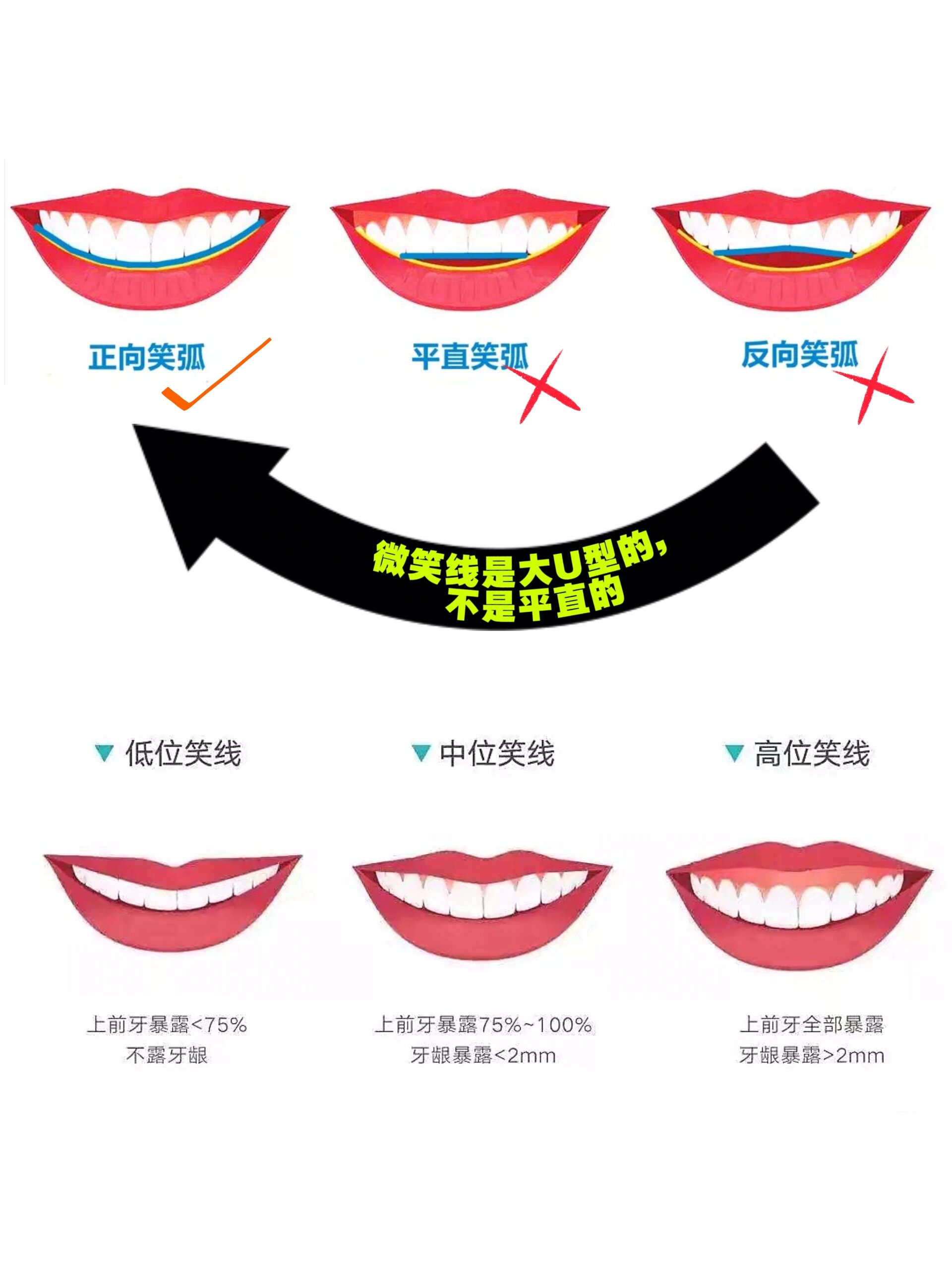 笑弧是每个人都有的么图片