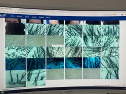 -雍禾植发全国连锁