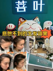 -菩叶脱发白发中心