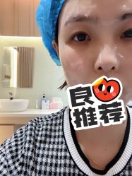 体验前-深圳鹏爱悦心医疗美容医院
