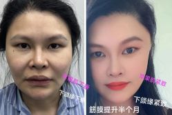 -恒博天姿医疗美容