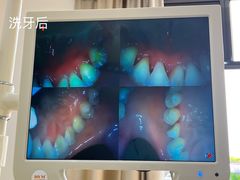 -赫尔森口腔·牙齿种植修复