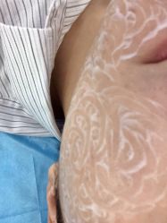 -深圳鹏爱悦心医疗美容医院
