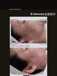 -E.beauty驻颜·痘敏肌调理中心