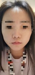 体验后-禾美嘉医疗美容