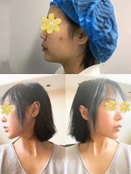 体验前-西安现代妇产医院医疗美容