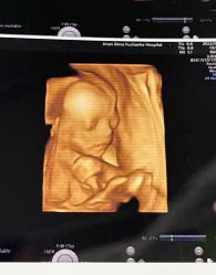 -济南艾玛妇产医院