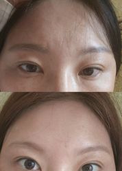 -比华利美容医院