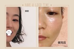 -FACE·日本小颜矫正美容整骨サロン