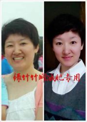 -绿竹·竹罐瘦身养生馆
