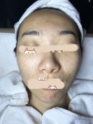 -皇族养心堂·净痘·修敏·御颜