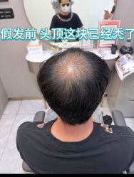 -唐风采假发补发定制