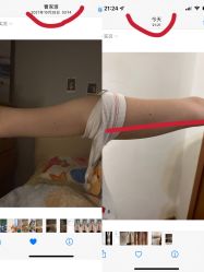 体验前-洁铭新加坡医美