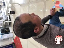 -大麦微针植发丨全国连锁