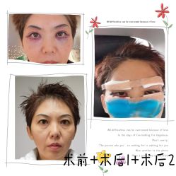 体验前-华臣医疗美容
