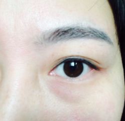 -元熙兰积皮肤管理