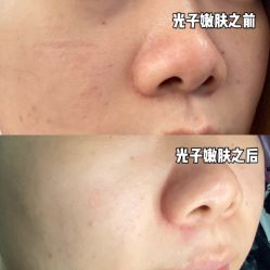 点击看大图 -顺德壹加壹美容医院
