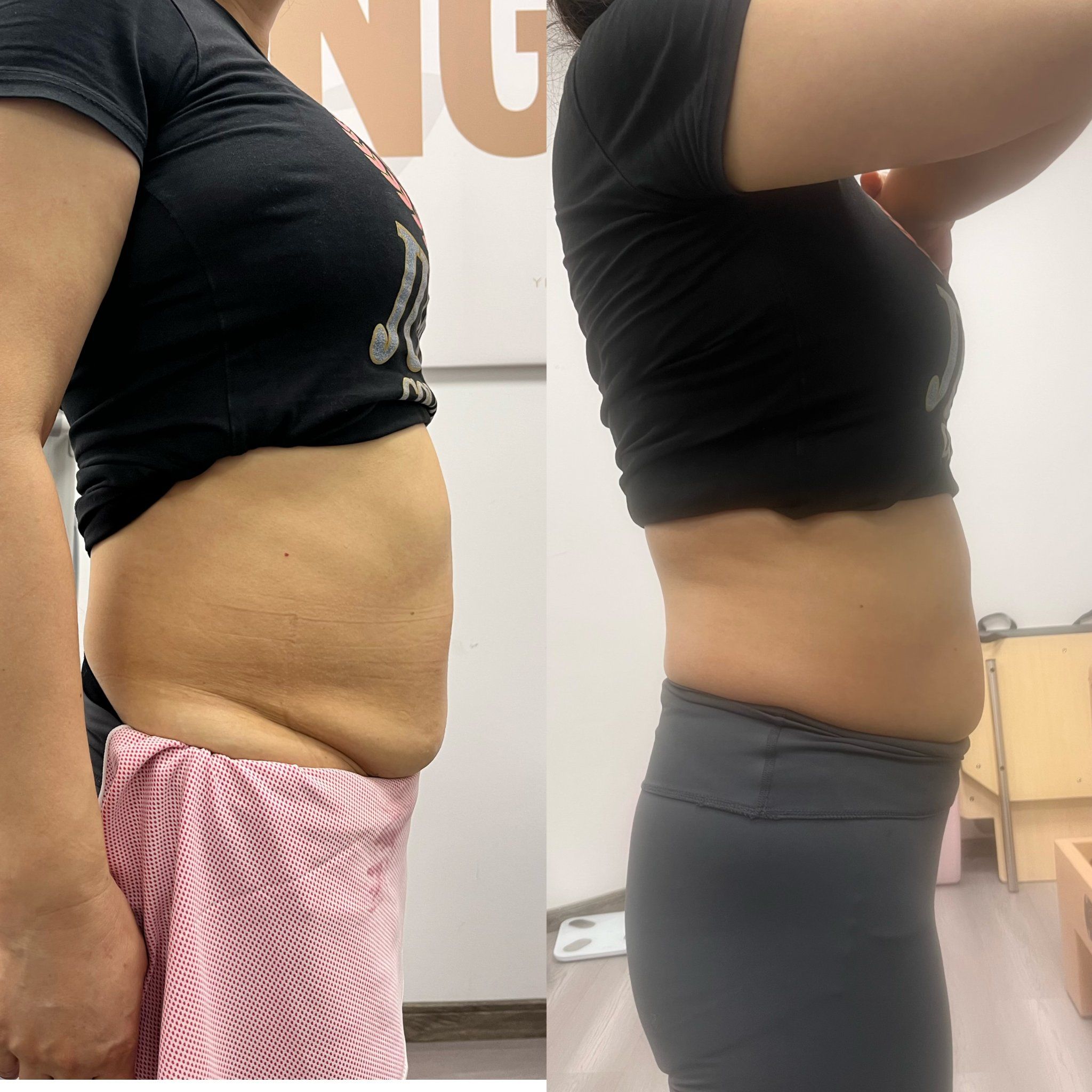 塑形减肥我们艺韵就是不错一个不错的选择