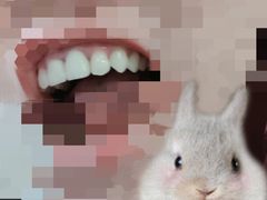 -Dr.Z dental仁康种植矫正中心