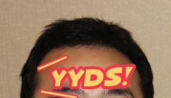 -大麦微针植发丨全国连锁