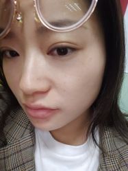 体验后-深圳美莱医疗美容医院