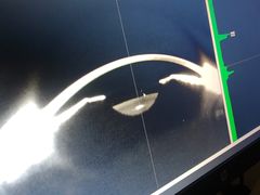 -西安普瑞眼科医院·近视手术·视力防控